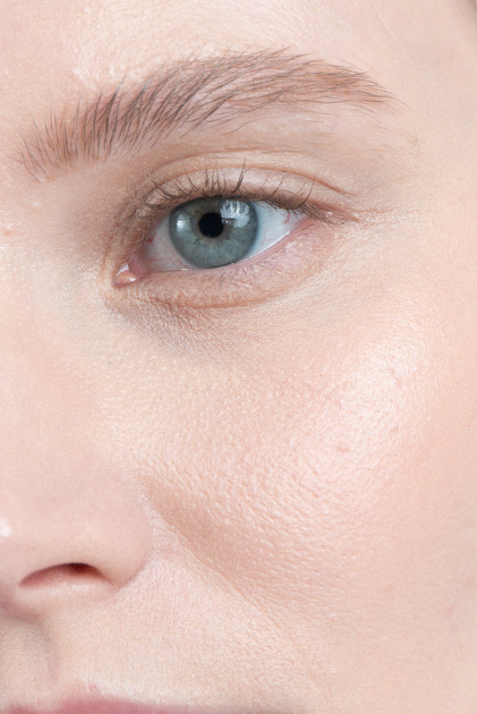 Vitamine-A en Acne: Natuurlijke oplossingen voor een gezonde huid