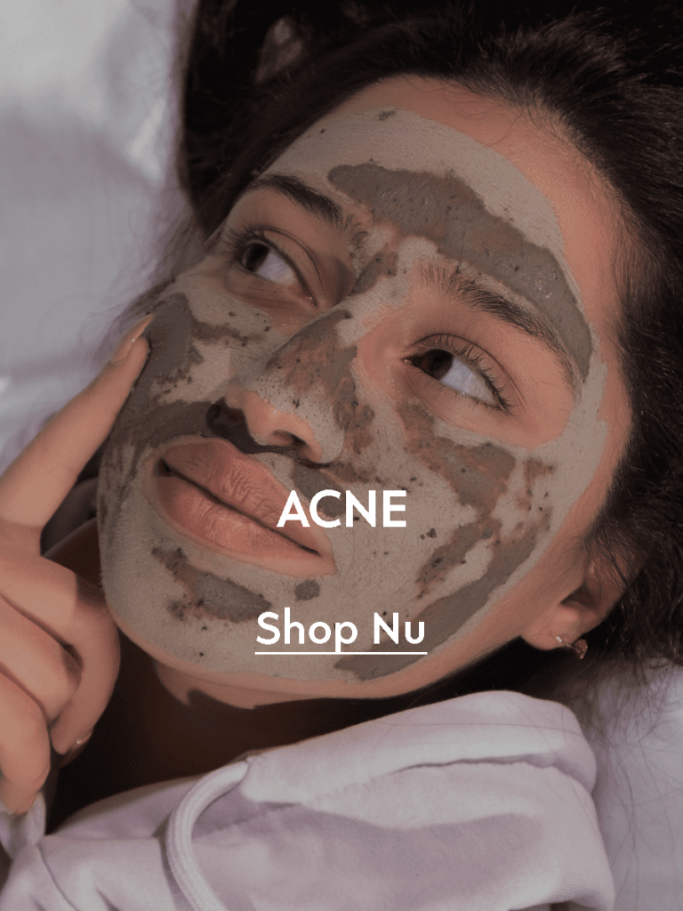 ACNE